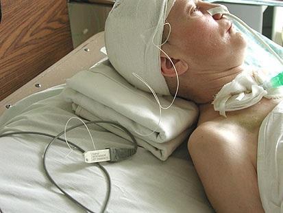 Внутричерепное давление – причины, симптомы и признаки (у взрослого, у ребенка), диагностика, методы лечения. Как измерить? Как снизить повышенное внутричерепное давление?