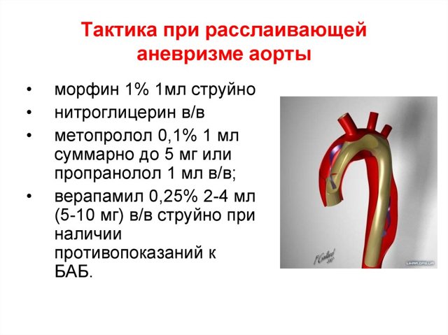 Лечение аневризмы брюшной аорты, операция аневризмы брюшной полости: цена в СПб.