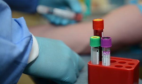Сегментоядерные нейтрофилы повышен: у ребенка и взрослого, причины