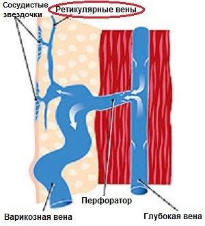 Кдо что это такое | Все о ретикулярном варикозе