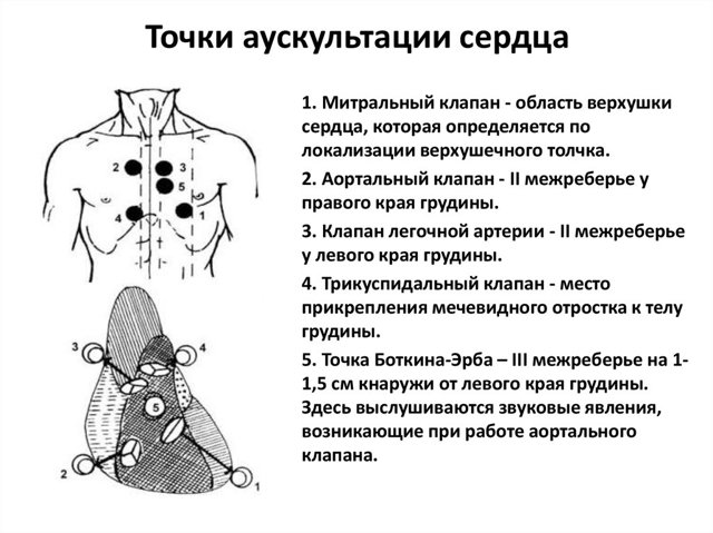Пароксизмальная мерцательная аритмия: причины, лечение