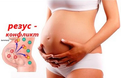 Беременность и группа крови