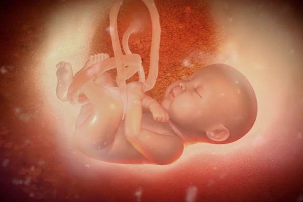 Киста сосудистого сплетения головного мозга: возникновение, диагностика, лечение. Опасна ли киста сосудистого сплетения для новорожденного?