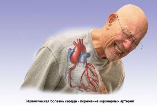 Велоэргометрия (ВЭМ). Проведение сердечного диагностического теста.