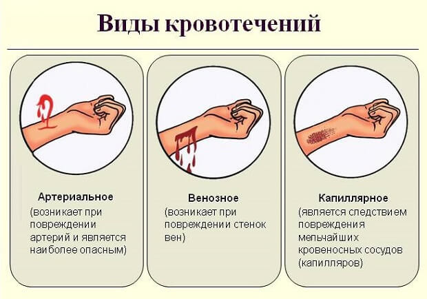 Первая помощь при капиллярном кровотечении - ОРЗ нет!