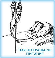 Операция на двенадцатиперстной кишке последствия. Прободная язва двенадцатиперстной кишки: диета после операции. Лечение желудочной язвы