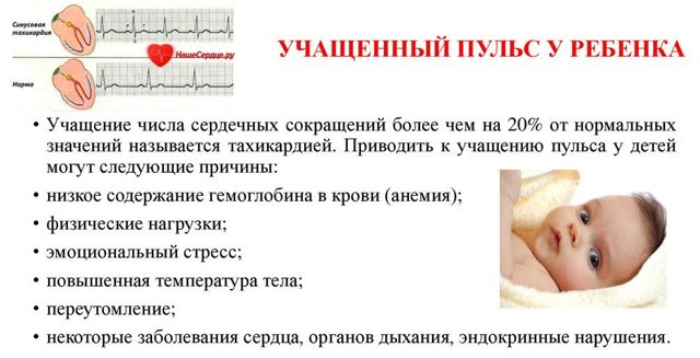 Пульс при ходьбе: норма у мужчин и женщин