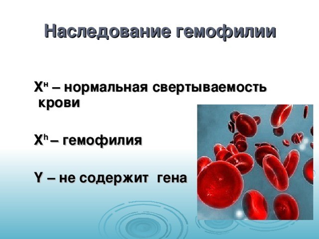 Почему гемофилия - царская болезнь