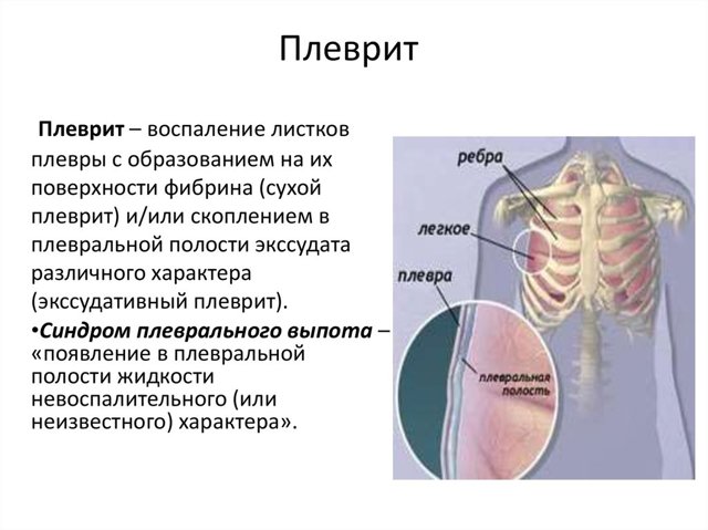 Боль в правой груди: что это может означать