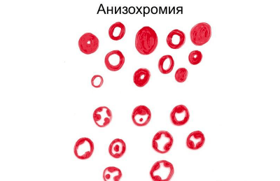 Анизохромия что это такое