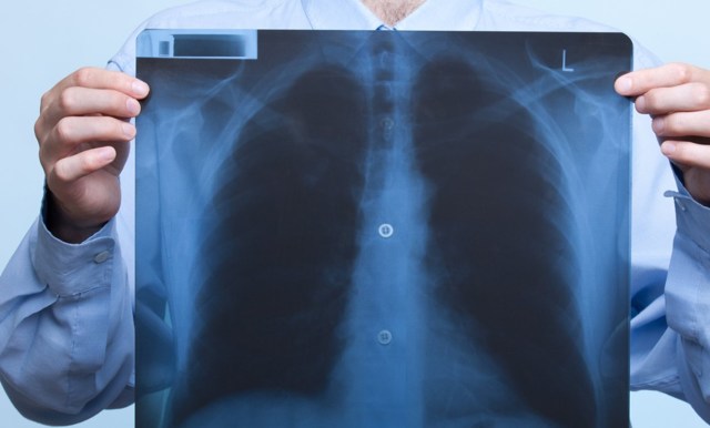 Мокрота с кровью при кашле – кровь в слизи при отхаркивании 2019