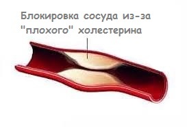 Высокое нижнее давление – причины и интересные факты