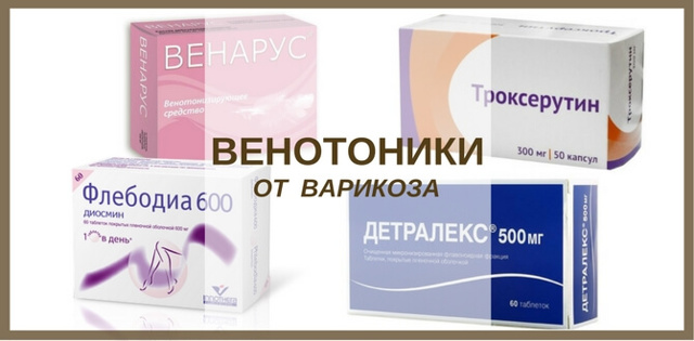 Флеболиты в малом тазу у мужчин - Все про холестерин