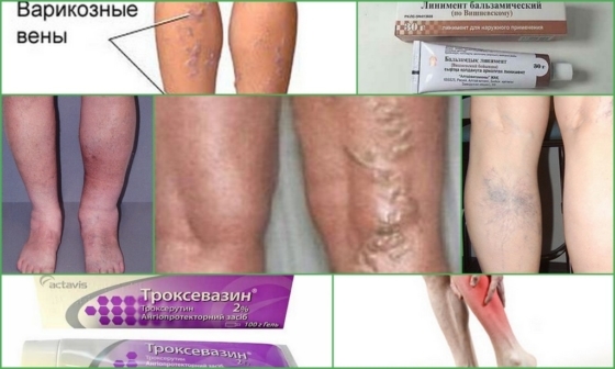 Гепариновая мазь – противотромботическое лекарство
