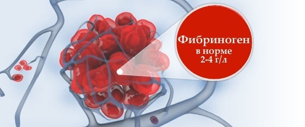 Фибриноген выше нормы – что это значит, что это такое, что делать? Фибриноген в крови – норма у женщин