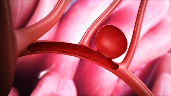 Как проверить сосуды головного мозга и шеи: перечень обследований