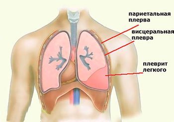 Боль в грудине посередине при вдохе, при нажатии, при движении – причины