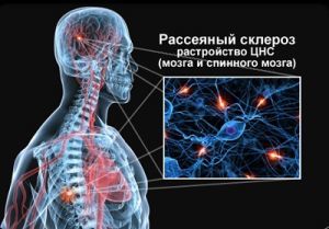 Тизалуд - инструкция по применению, описание, отзывы пациентов и врачей, аналоги