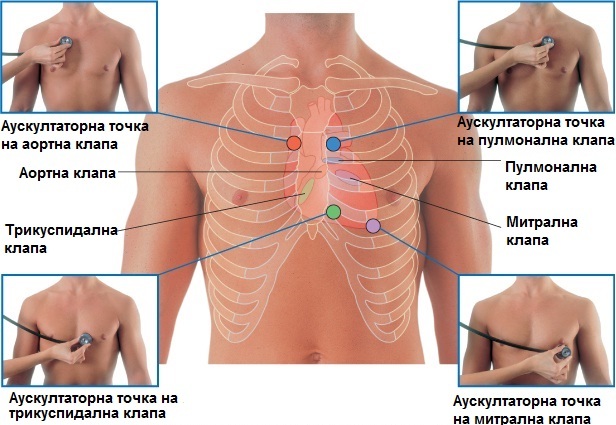 Аускультация: шумы сердца - Секреты клинической диагностики - Медицинская учебная литература