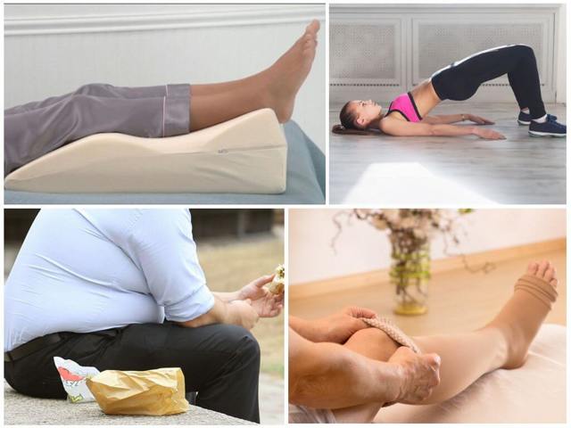 Отеки при варикозе - снимаем быстро и надолго