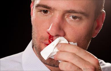 Первая помощь при кровотечении из носа: как правильно оказать медицинскую помощь (алгоритм) при сильном кровотечении, что нужно делать чтобы из носа пошла кровь без боли