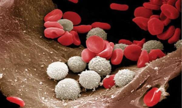 Тромбоциты понижены, лейкоциты понижены