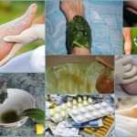 Народные средства от тромбофлебита нижних конечностей: травы, мед, лечение в домашних условиях