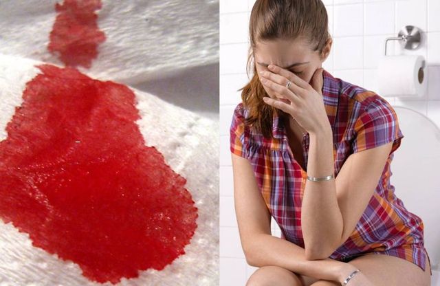 Выделения красные, но не месячные: причины