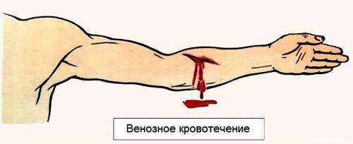Венозная кровь человека в отличие от артериальной. Отличия венозной и артериальной крови