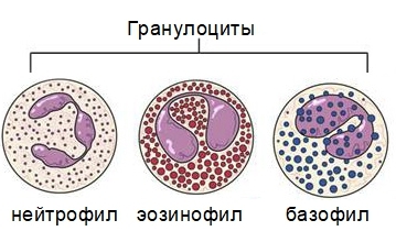 Гемофагоцитарный лимфогистиоцитоз - причины, симптомы, диагностика и лечение