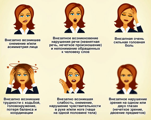 Микроинсульт симптомы первые признаки у женщин