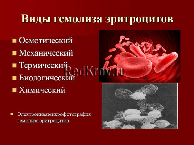 Гемолиз - это что? Гемолиз крови, частичный гемолиз