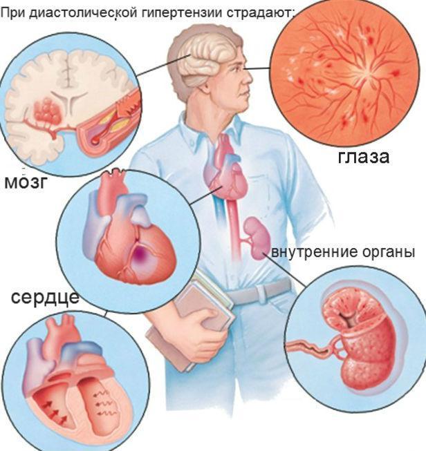Как снизить сердечное давление в домашних условиях