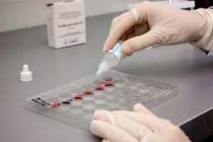 Как узнать свою группу крови: с помощью цоликлонов, стандартными сыворотками, алгоритм действий, инструменты и методы