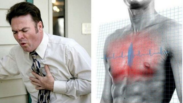 О Чем Говорит Боль в Грудной Клетке Посередине