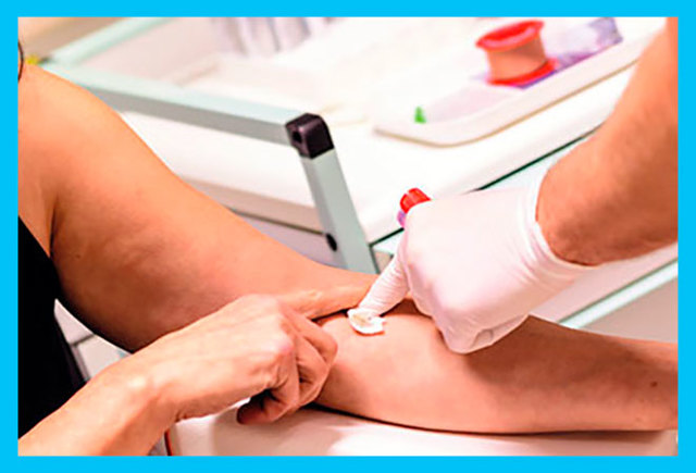 Гормон ФСГ в крови - Повышенный гормон ФСГ у женщин в лаборатории Lab4U