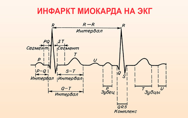 Гипоксия сердца симптомы и лечение
