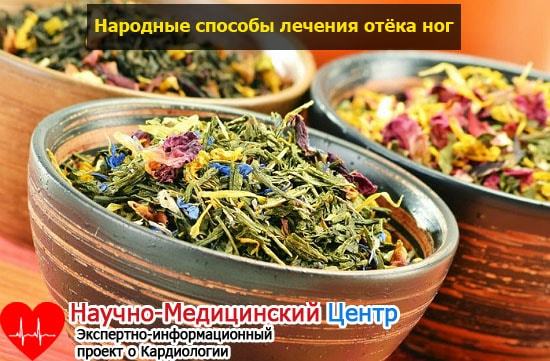 Отеки ног при сердечной недостаточности