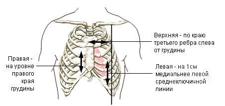 Границы сердца: норма у взрослых, детей, виды границ, сердечная тупость, лечение