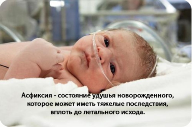 Неинвазивный мониторинг ВЧД у детей