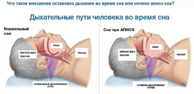 Начал задыхаться перед сном - Вопрос психологу