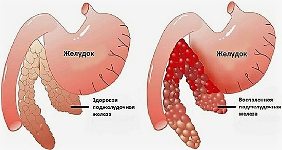 Боль в правой груди: что это может означать