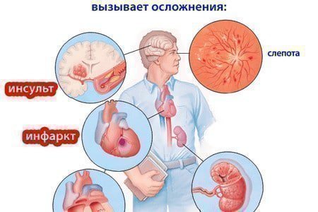 Как курение влияет на сердце человека: тахикардия, пульс, мерцательная аритмия