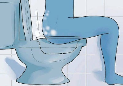 Геморрой - лечение, симптомы, как лечить в домашних условиях