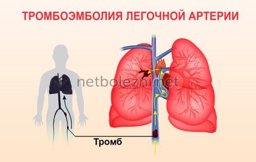 Антикоагулянты – механизм действия, список препаратов