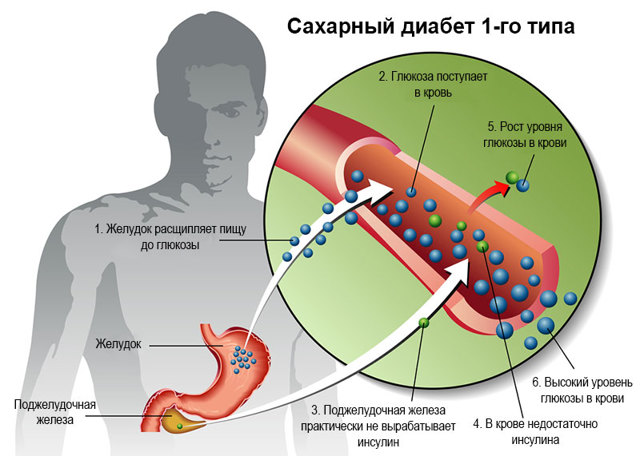 Амлодипин или энап что лучше - Все про гипертонию