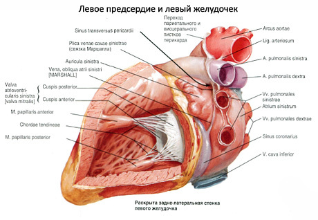 Ложная хорда левого желудочка - причины и лечение