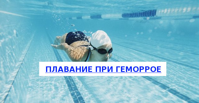 Можно ли плавать в бассейне при геморрое — Сайт о геморрое