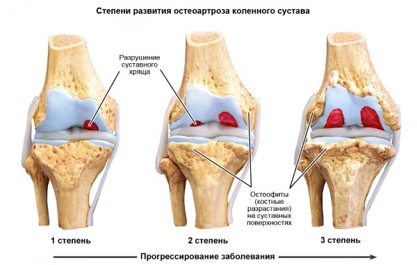 Артрокер – инструкция по применению, цена, отзывы, аналоги капсул