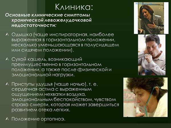 Сердечная недостаточность 2 а